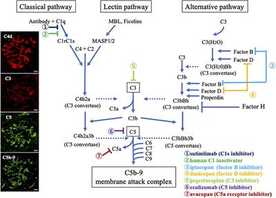 Role of complement activation in anti-neutrophil cytoplasmic antibody-associated glomerulonephritis